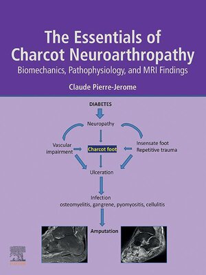 cover image of The Essentials of Charcot Neuroarthropathy